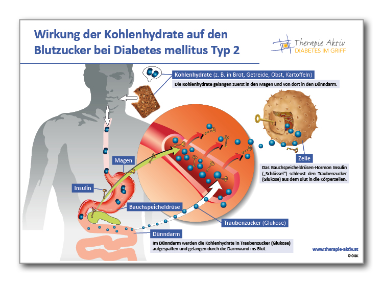 Schautafeln als Ergänzung der Schulungsunterlagen; Quelle: Therapie Aktiv